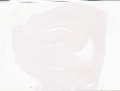 ['deident_d185766d-8dcb-439a-804d-8bfde9b038e9_69b05fbe.jpg']