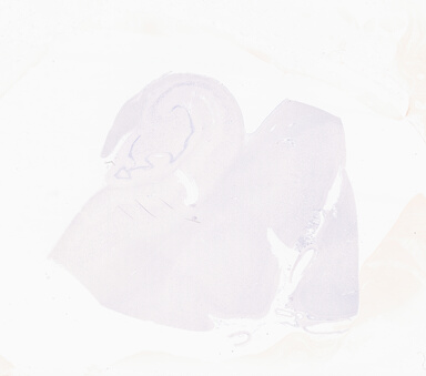 ['deident_e3042374-a714-457c-955c-d5f42c22aabf_69b05fc6.jpg']