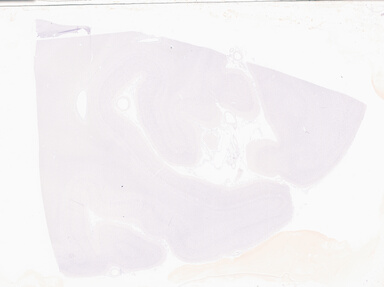 ['deident_04a42cc1-0e89-4505-b102-1afa42e7f1f0_69b05f68.jpg']