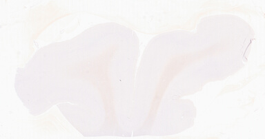 ['deident_c7811f71-e358-4254-b134-1ff4724bf853_69b05fb9.jpg']