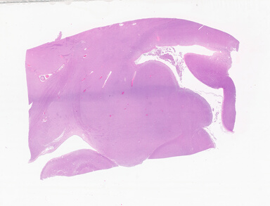 ['deident_14e9e3ab-5bf1-4338-99e9-0f7a661d1fd8_69b05f6c.jpg']