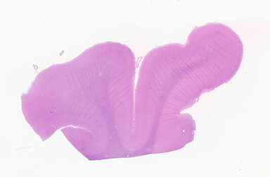 ['deident_7403a2c2-39fd-469c-bf47-d21d869c813f_69b05f8b.jpg']