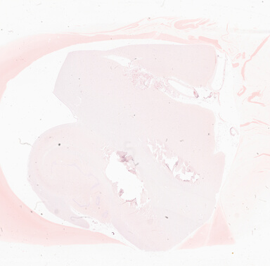 ['deident_7e645bd2-8e17-4bf1-93e5-09888cd6fdca_69b05f92.jpg']