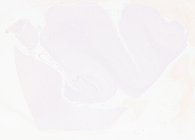 ['deident_1e52cbe2-04ae-48b3-b130-5a93bb68d0a7_69b05f74.jpg']