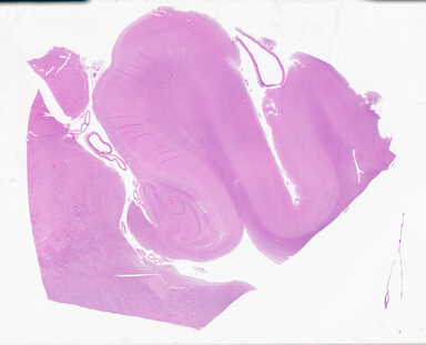 ['deident_6aaab522-ecfc-4a38-a992-ec4d966a98aa_69b05f87.jpg']
