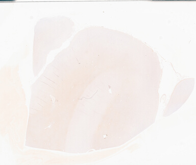 ['deident_e95413a3-6e38-484f-b0de-c3b07d83c154_69b05fce.jpg']