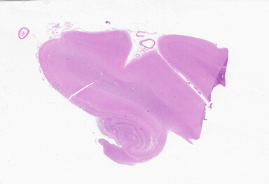 ['deident_193431bc-e795-4cee-b902-23d61c8d0edd_69b05f70.jpg']