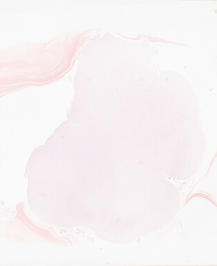 ['deident_21e82852-b38a-4f11-b78f-e4a3a85b2ab0_69b05f76.jpg']