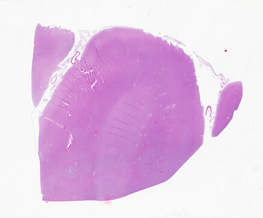 ['deident_79afd711-dd5a-4927-87b0-b53528e6dd96_69b05f8f.jpg']