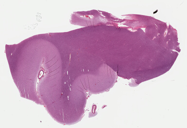 ['deident_cd743ab2-4aaa-4eab-aa7d-4fe22949e0bb_695fc17c.jpg']