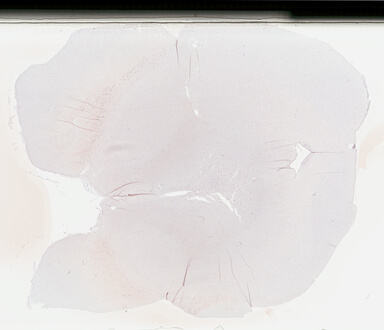 ['deident_16932a81-d3e7-482c-ae3c-3c95fef04390_695fc123.jpg']
