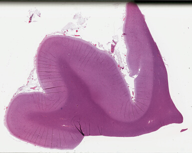 ['deident_c9eb9b7f-bb62-45d9-837e-a87dbd761307_695fc172.jpg']