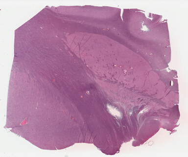 ['deident_e6696500-9ea3-4e18-8b14-374421d28d96_695fc18a.jpg']