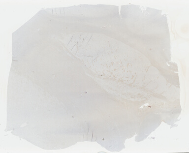 ['deident_806b42f8-db46-4718-845e-4b9e007f7c58_695fc152.jpg']