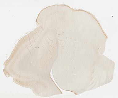 ['deident_bdb18626-76eb-46cc-93be-84e65a371031_695fc16d.jpg']