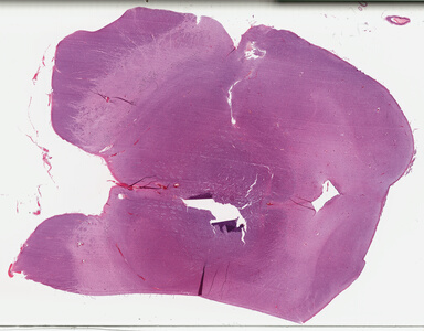['deident_d849dc1c-7d95-4ae4-8b70-4801408be88a_695fc181.jpg']