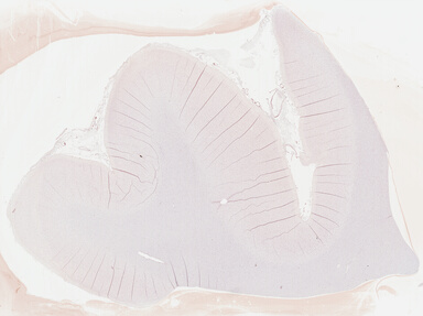 ['deident_63ab47ee-b544-4541-9046-c6089b73a1e0_695fc146.jpg']
