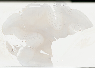 ['deident_ff573195-9b9e-450c-bc60-86924749e18d_695fc19b.jpg']