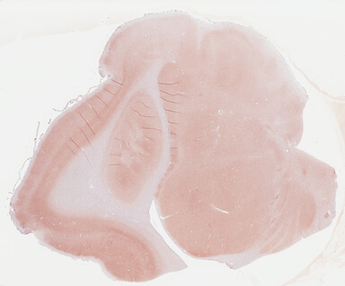 ['deident_d01a1a96-ba48-4935-b618-0da80b825424_695fc17e.jpg']