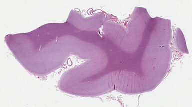 ['deident_1e186f72-0024-49fc-83e3-6850990e770c_695fc12b.jpg']