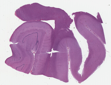 ['deident_9e5b2422-2ddc-4f65-aec2-e2dff0180d74_695fc160.jpg']