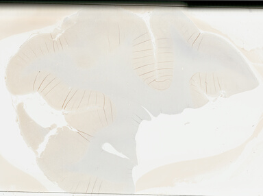 ['deident_9ad1d93f-fbfe-43d1-8276-98a7a4efbf3b_695fc15a.jpg']
