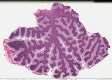 ['deident_cc972ef0-dbe4-44c8-993c-ee80f14e612f_695fc177.jpg']