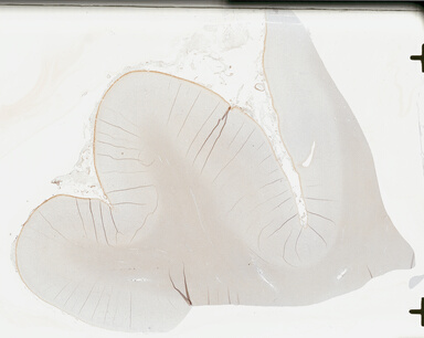 ['deident_aa25134d-4dae-47e7-aeb4-924fdf66d7b6_695fc165.jpg']