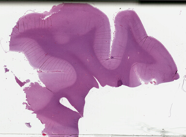 ['deident_2a51744a-f840-4baf-b46f-00f91de2145e_695fc12f.jpg']