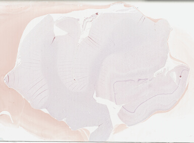 ['deident_9da5d21f-96a3-4af3-b8a5-f696a5e7974d_695fc15f.jpg']