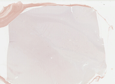 ['deident_5c1748f8-39b1-4de6-b436-88a17139b86f_695fc13f.jpg']