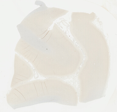 ['deident_8c87d675-6d5f-455a-ae5f-6cca725ccea7_695fc155.jpg']