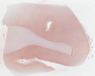 ['deident_4ed0979f-7555-4ba0-8660-34886f6b8b7b_695fc5f0.jpg']