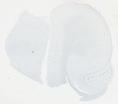 ['deident_b3482359-e5f0-40e6-8ba6-7005522b03b6_695fc61d.jpg']