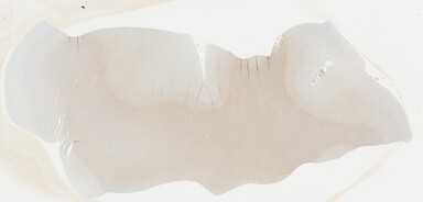['deident_7eaad3b7-97af-4039-8ccd-b759136f1ce8_695fc5fd.jpg']