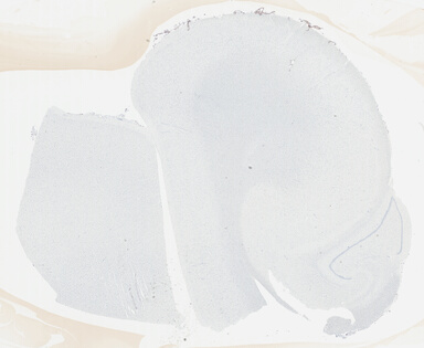 ['deident_1a6c8999-e9d7-479a-922a-e992ed54ad1b_695fc5e3.jpg']
