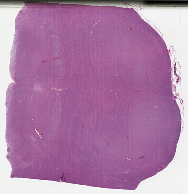 ['deident_86bb46fb-55c2-4fd5-b0e2-10d729f970ba_695fc605.jpg']