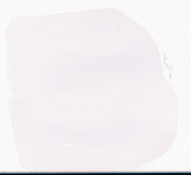 ['deident_ba0a8e6c-6178-44ca-9c2f-854c56a29a94_695fc621.jpg']