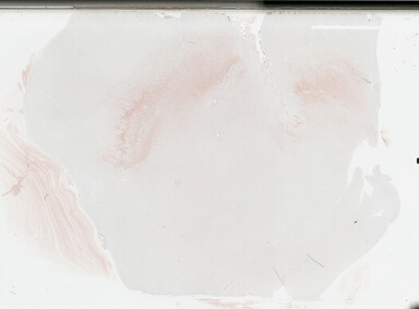 ['deident_af5a09d9-269e-4042-8518-972f0a370593_695fc619.jpg']