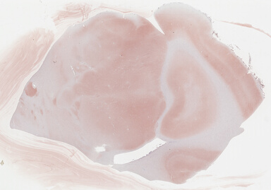 ['deident_614261ee-aee4-4e2d-89e9-5faa88f7c997_695fc5f2.jpg']
