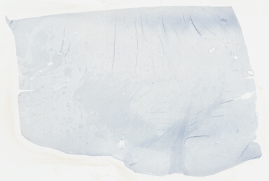 ['deident_e6cc645d-5c0b-4189-bad7-fd1e6d994bd9_695fc62f.jpg']