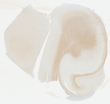 ['deident_fd3fac8e-fb6a-417f-b41c-3bbb5b63eb5b_695fc638.jpg']
