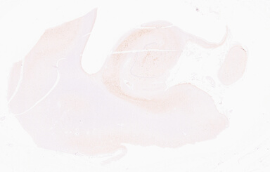 ['deident_f49b12e7-279e-4da1-a329-bf2a33be2f10_69d96a06.jpg']