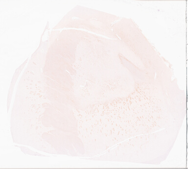 ['deident_9f816a2e-7c9b-4b79-bc3c-f79f1bf4f8ee_69d969c7.jpg']