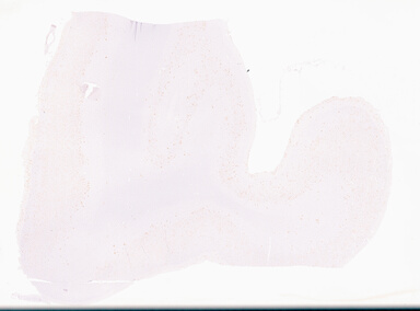 ['deident_8a146355-0a7a-4fc1-8291-cd5658b448eb_69d969bf.jpg']
