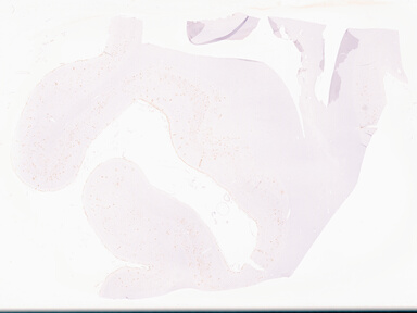 ['deident_a1937de6-ed2b-43eb-a13d-5a89c5168c41_69d969c8.jpg']