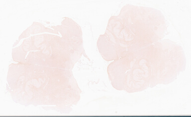 ['deident_6d7572e2-73c9-454d-b5ed-70076825f1a7_69d969b1.jpg']