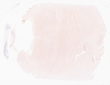 ['deident_580af011-6bf2-4618-9132-2b7be06563da_69d969a6.jpg']