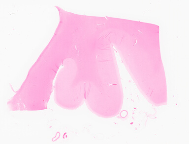 ['deident_02e4e40b-7456-4f67-ac32-c8d4830254d0_69d96970.jpg']