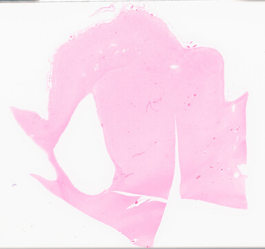 ['deident_6bab6cbd-d4b0-45b8-ba24-2ee57e653acf_69d969af.jpg']